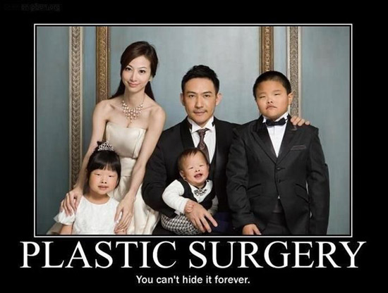 YOU CAN'T HIDE PLASTIC SURGERY FOREVER