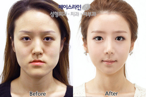 UGLY TO BEAUTIFUL BEFORE AFTER PLASTIC SURGERY